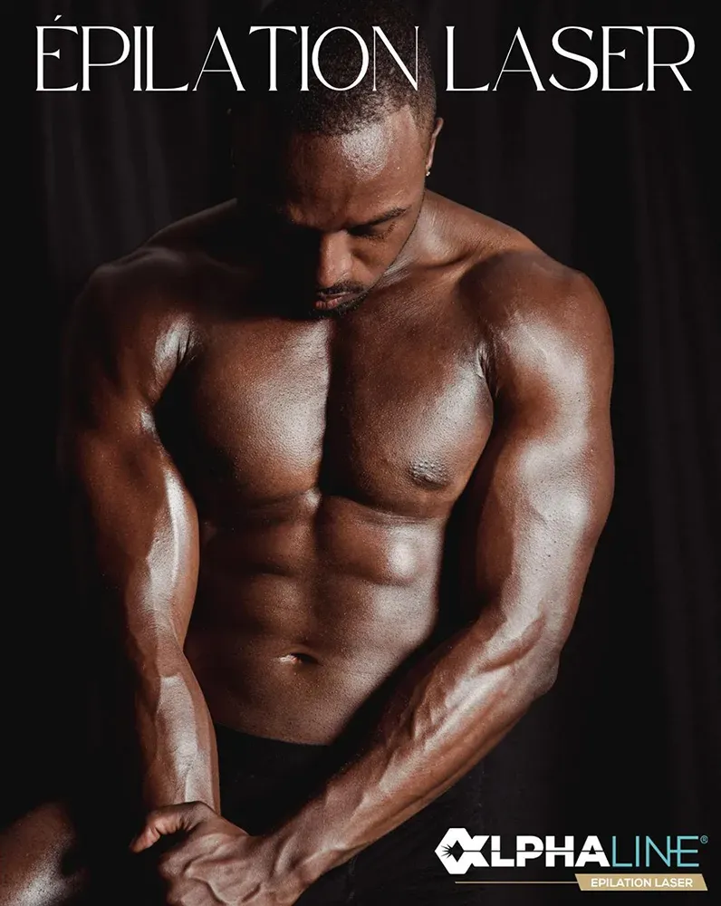 Épilation laser diode pour homme à Marseille